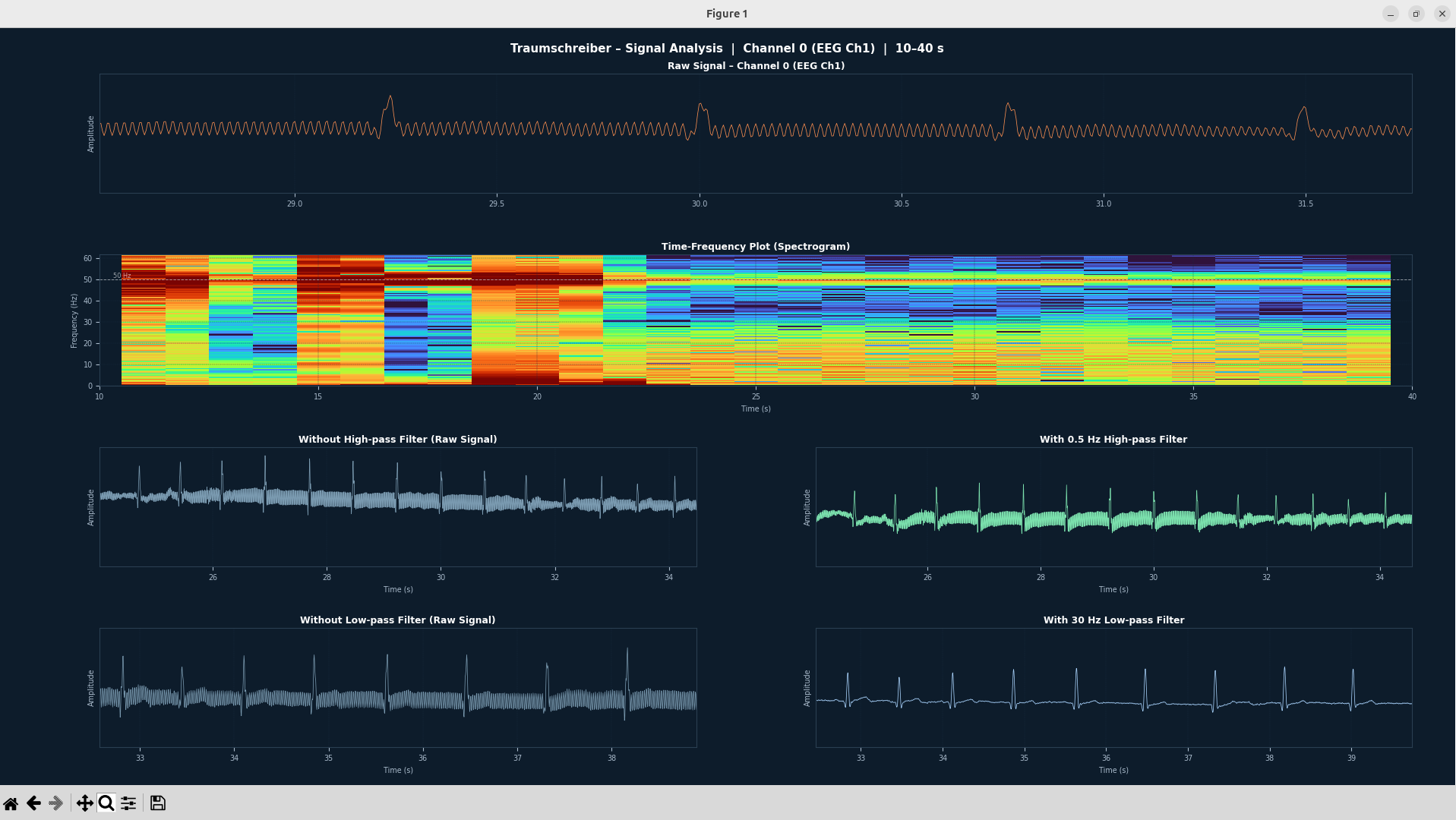 Zweites Beispiel: sauberes EKG-Signal mit Zoom