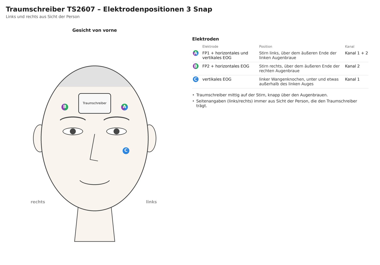 Elektrodenpositionen 3 Snap