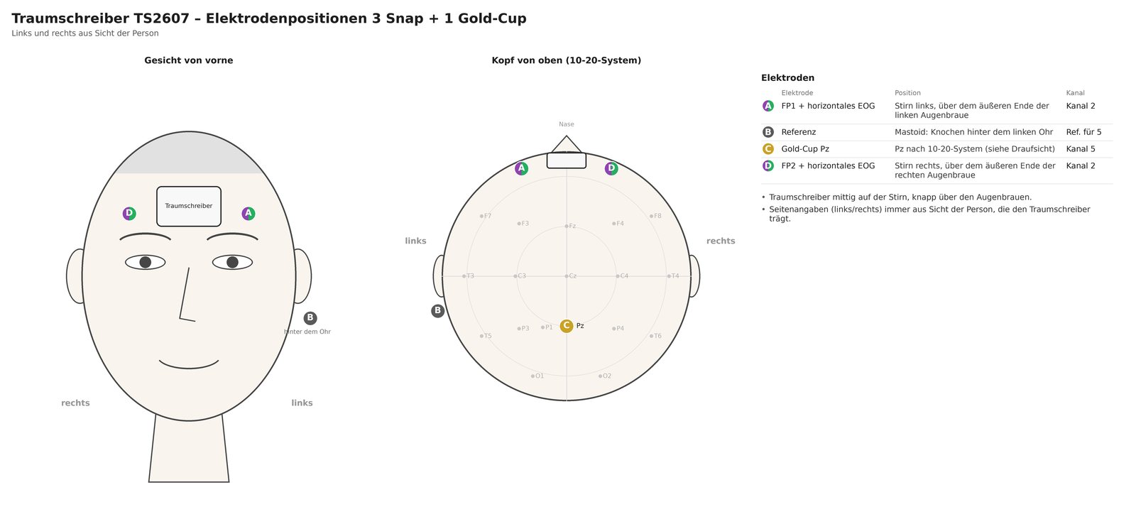 Elektrodenpositionen 3 Snap + 1 Gold-Cup, mit Draufsicht nach 10-20-System