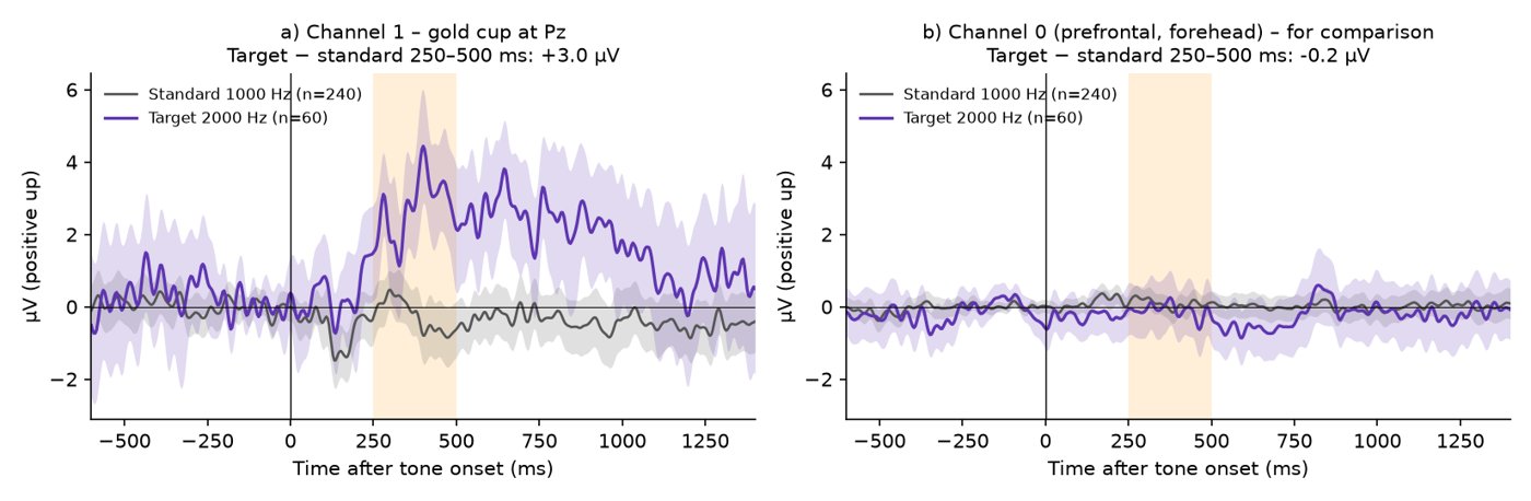 Averaged EEG response to target and standard tones at Pz with a clear peak after about 400 ms